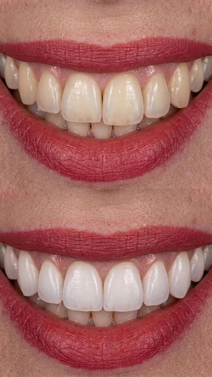 Registro fotográfico de una sonrisa, caso 4